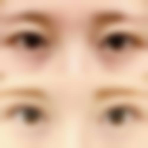 七、洛阳爱美医疗美容门诊部价格表：（仅供参考）