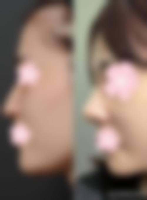 七、贵港悦玖医疗美容门诊部价格表：（仅供参考）