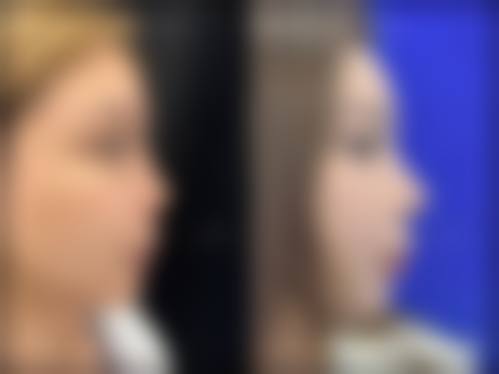 七、温州东华医院整形美容中 心价格表：（仅供参考）