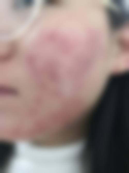 七、大竹SkinClinic真实的顾客评价如下：