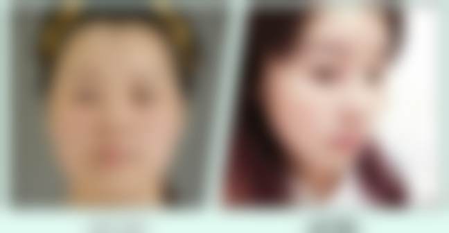 北京禾美嘉医疗美容门诊部余班林18年经验的优势