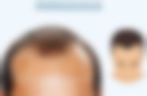 三、杭州伊佳整形医院医生介绍: