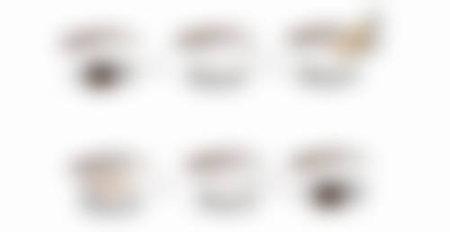 四、哈尔滨艺诗美尔整形医院实例