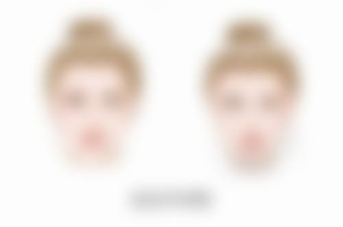 医美物理疗法：快速去除眼袋的好选择