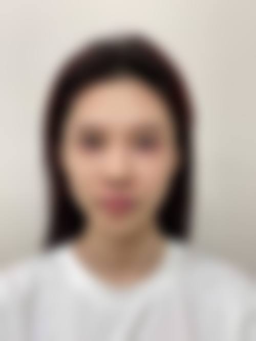 金璐怡医生口碑和评价