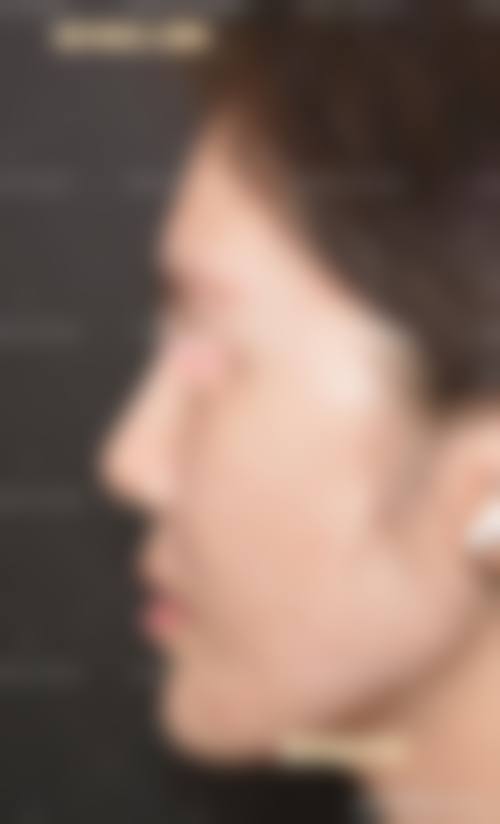 五、宁德洛妃整形医院实例