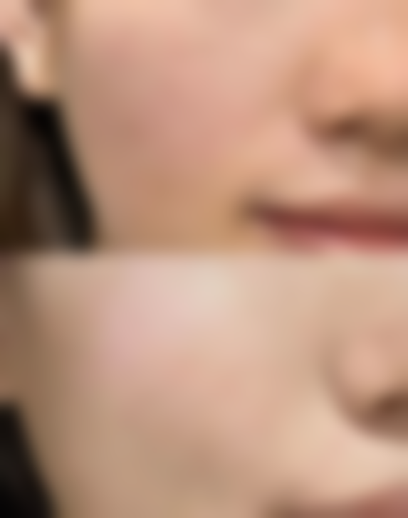 术后与日常维护：巩固治疗成效的关键