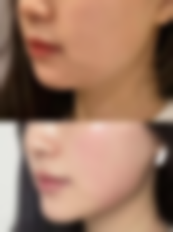 五、北京善德尔整形医疗美容怎么预约：