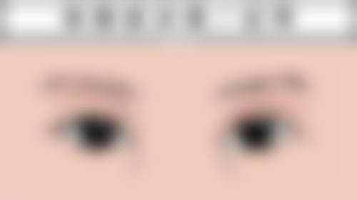 指甲抠出的疤痕去除：药物治疗显神通