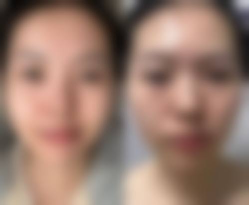 八、郑州妍喜医疗美容门诊部真实的顾客评价如下：