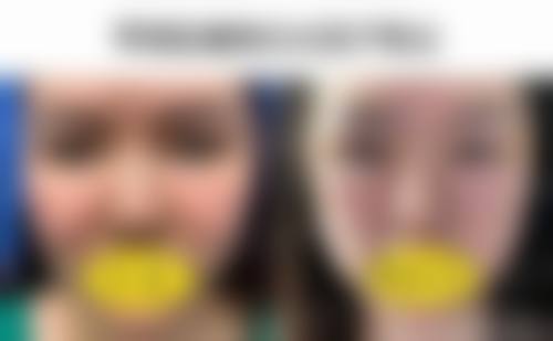 八、南京伊美莱医疗美容诊所真实的顾客评价如下：