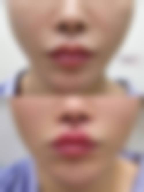 八、郑州艾伯丽医疗美容诊所真实的顾客评价如下：