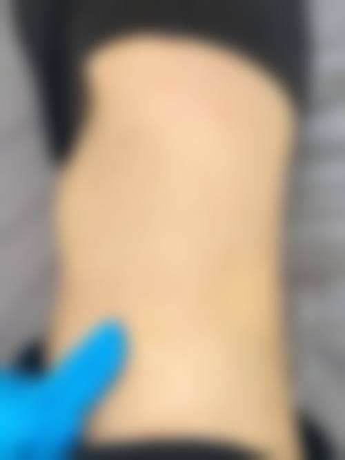 五、南京伊美莱医疗美容诊所实例