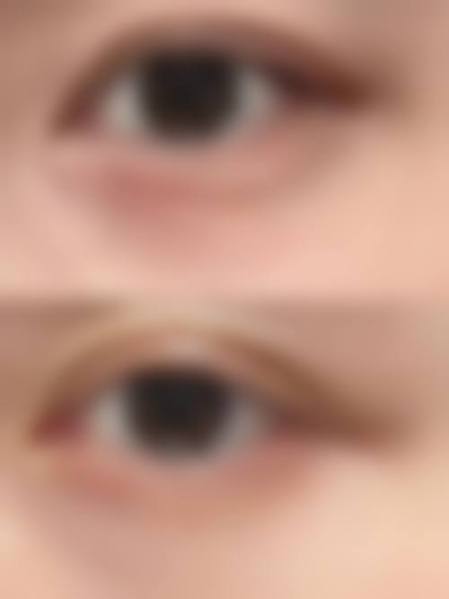 七、郑州妍喜医疗美容门诊部价格表：（仅供参考）