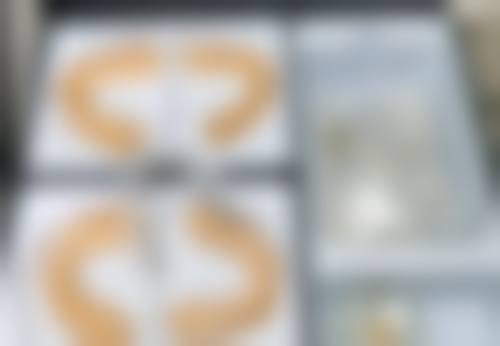 美妍高科去眼袋，20分钟治疗可行吗？