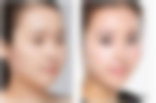 六、杭州澜星医疗美容诊所怎么预约：