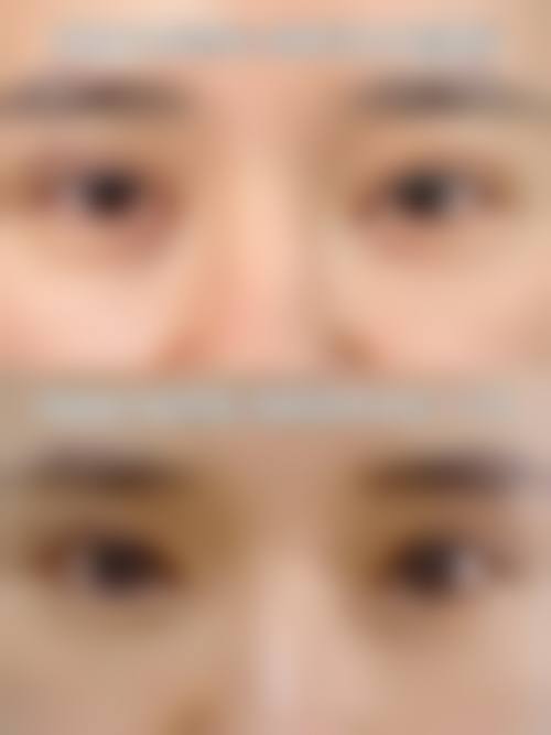 五、泉州华秀整形医院实例