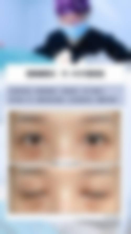 五、ARTLINE医院实例