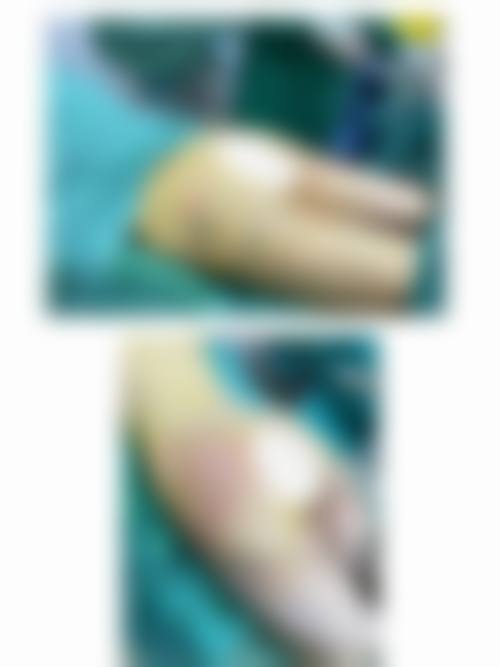 五、乌鲁木齐美妍爱惠医疗美容诊所实例