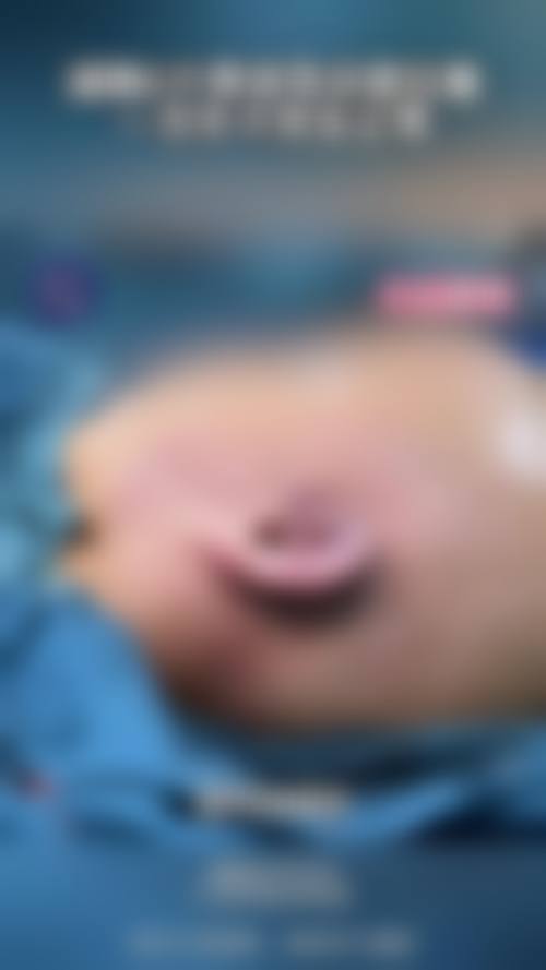 八、咸宁安美医疗美容门诊部真实的顾客评价如下：