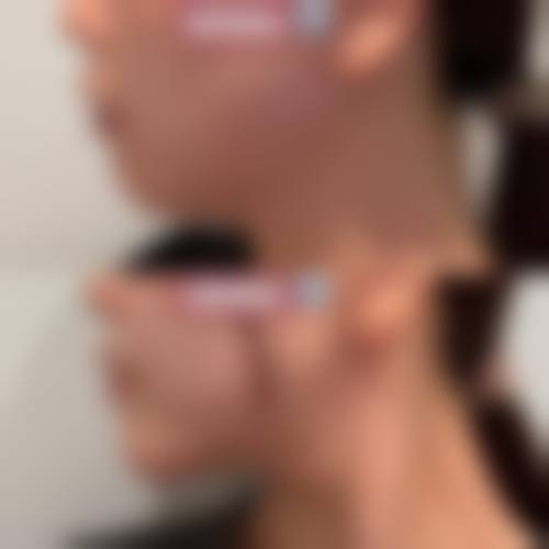 曾明福医生怎么样可靠吗？