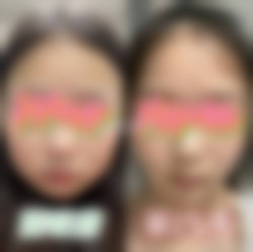 曾明福医生在哪家医院怎么预约？