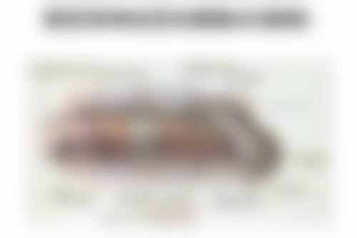 头发稀少做毛发种植,自然浓密成效看得见