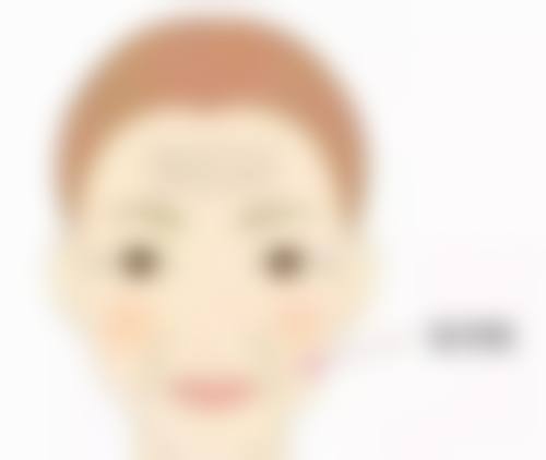 头发稀少选择毛发种植,持久成效有保护