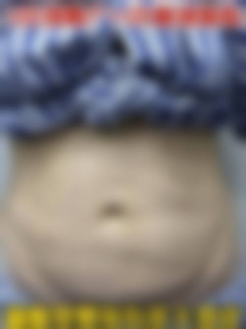 六、贵阳中医学校第二附属医院整形外科怎么预约：