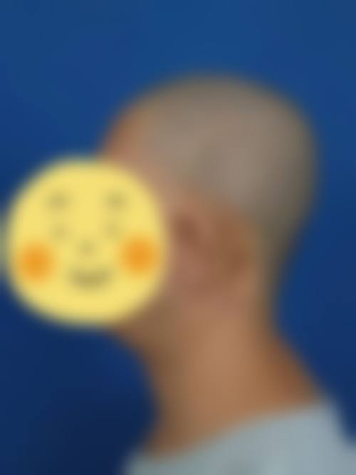 五、陕西同安济医院激光美容中 心实例