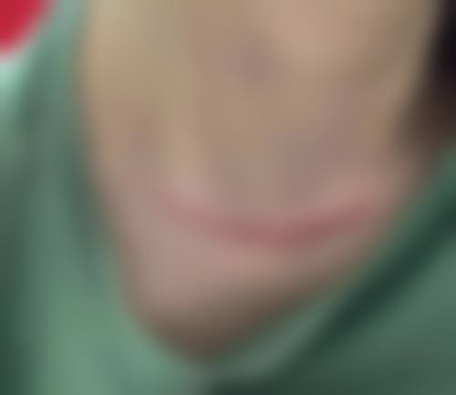 八、上海市第七人民医院烧伤整形门诊部真实的顾客评价如下：