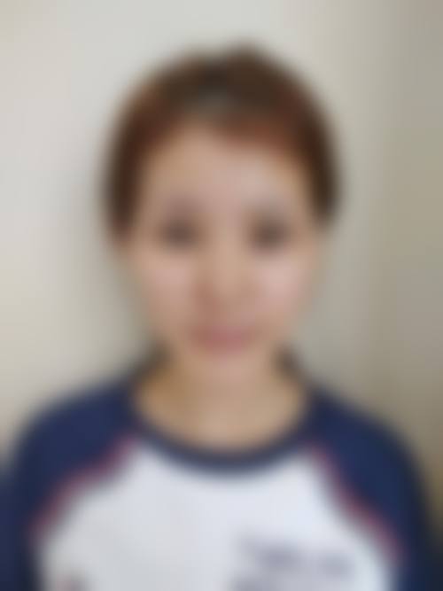 四、昆山灵美东方整形医院实例