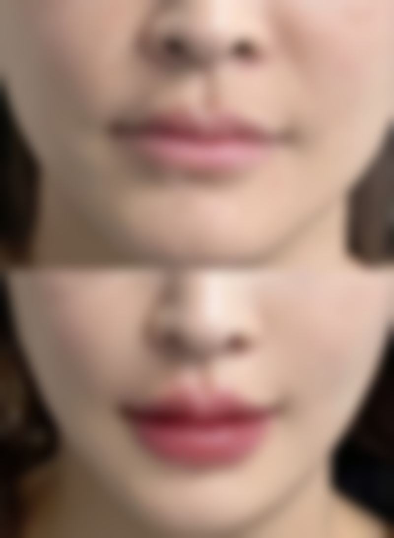 揭秘!作息与生活习惯和黑眼圈、眼袋的关系