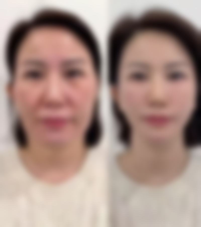 五、永州润本初颜医疗美容诊所实例