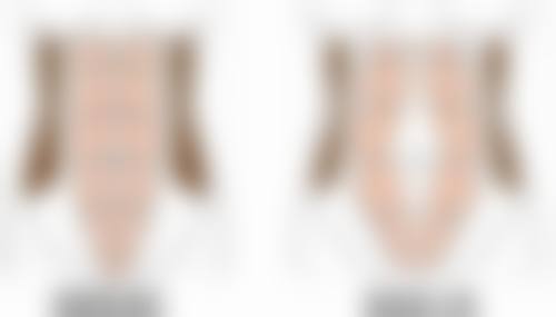 如何轻松去除下眼袋？多种手术与非手术方式，长效改善眼周形态、优化轮廓