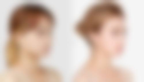 四、扬州星璨之星整形医院实例