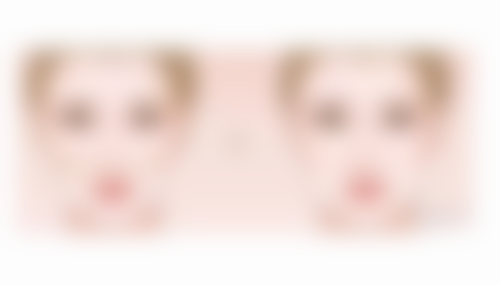 橄榄油能消除哪些类型的眼袋?