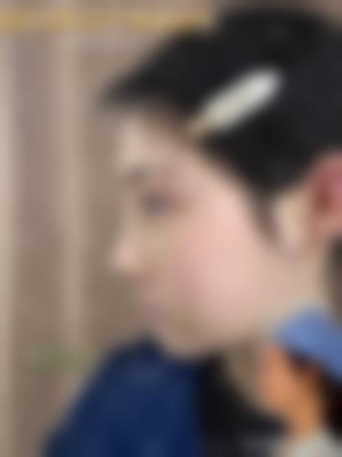 七、温州泰顺华华整形外科门诊部价格表:(仅供参考)