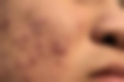 二、苏州银康皮肤病门诊部正规吗?来看看医院资质: