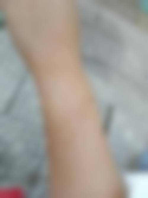 付晋凤医生实例