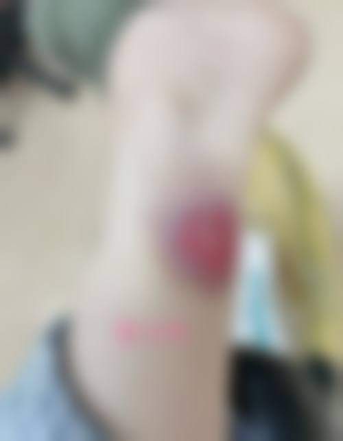 付晋凤医生在哪家医院怎么预约？