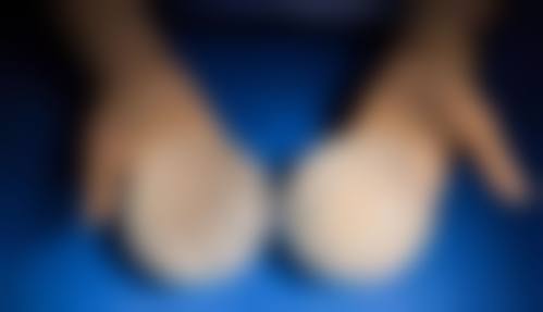 七、中山九九医疗美容门诊部真实的顾客评价如下：