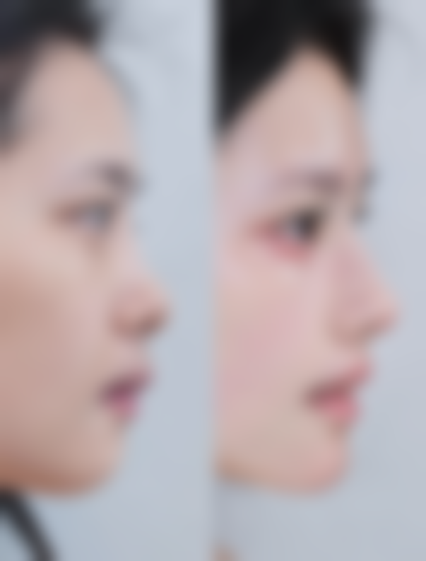 五、扬州星璨之星整形医院怎么预约：