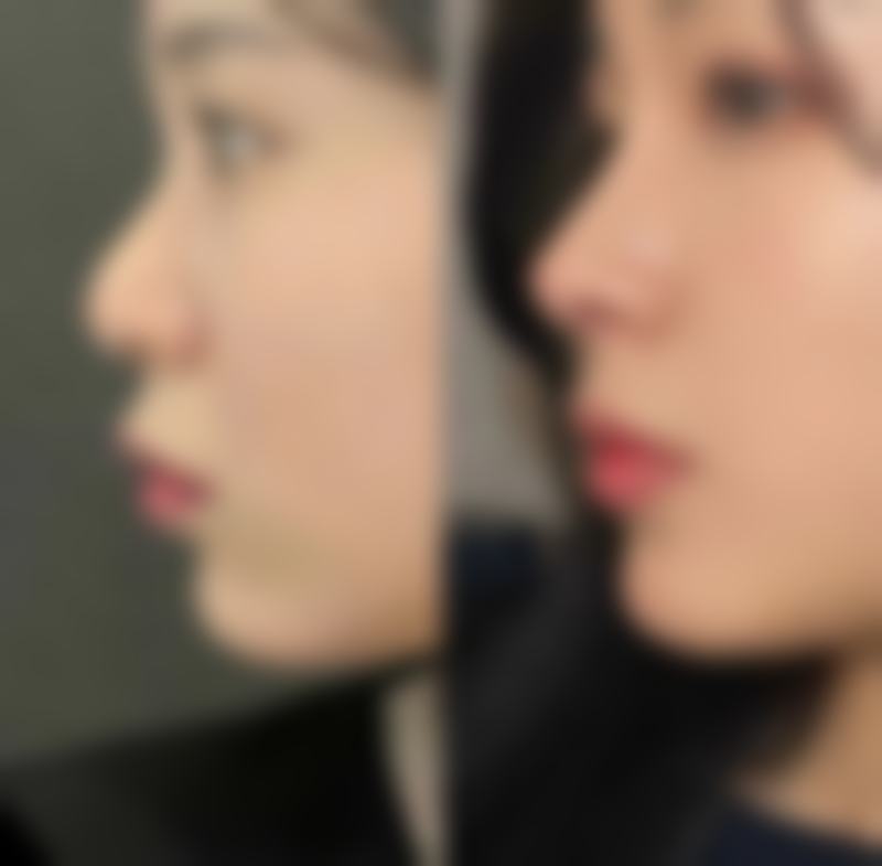 五、襄阳辰美医疗美容门诊部怎么预约：