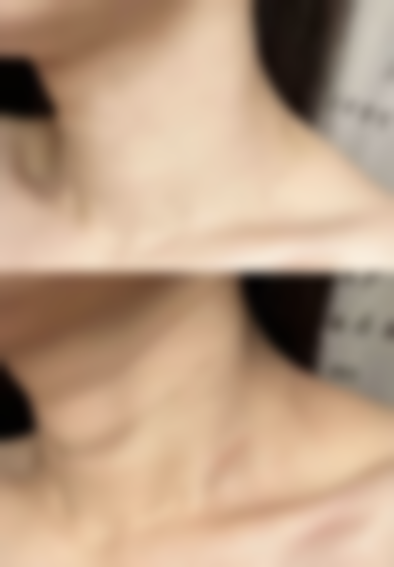 七、襄阳辰美医疗美容门诊部真实的顾客评价如下：