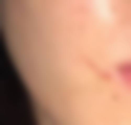 苏晓利医生实例