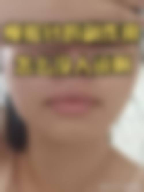 胡瑾医生在哪家医院怎么预约？