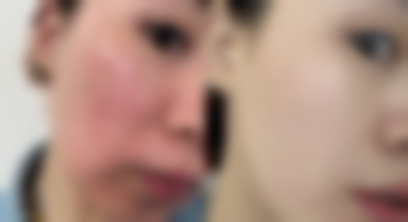 五、桂林诺澜登整形美容诊所实例