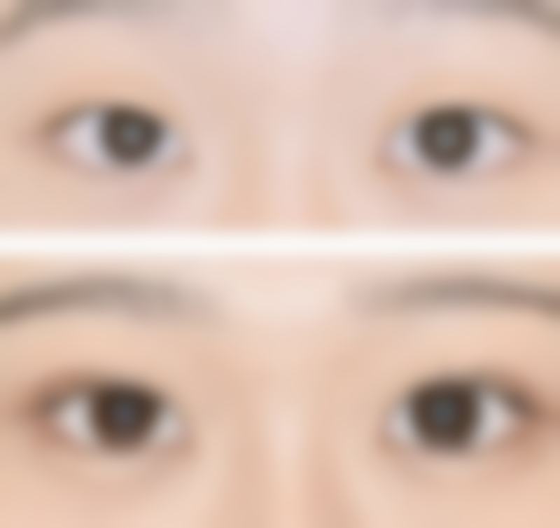 六、永城卓尔美医疗整形诊所价格表：（仅供参考）