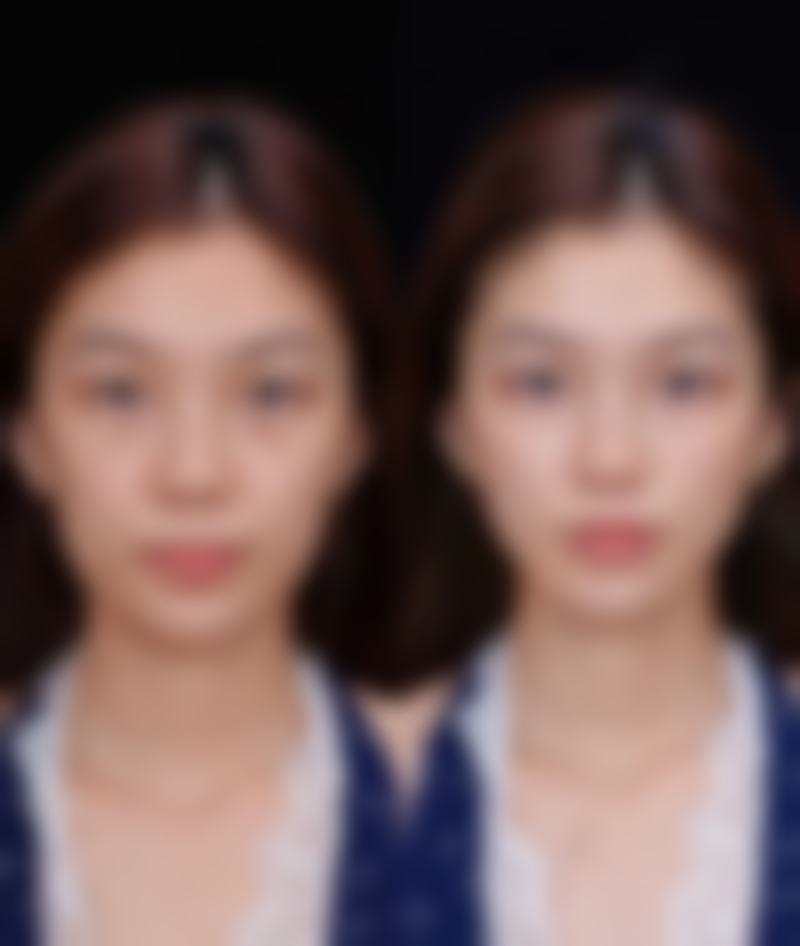 七、合肥瑶海童颜美医疗美容门诊部价格表:(仅供参考)